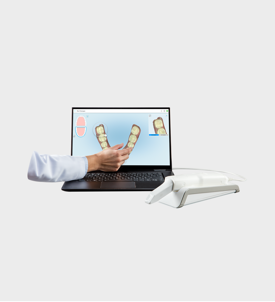 iTero Element 6個セット 新品6箱➕9個159個入り iTero エレメント 5Dプラスシリーズ | 製品・ソリューション