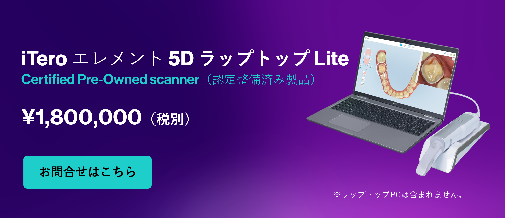 iTero オンラインショップ